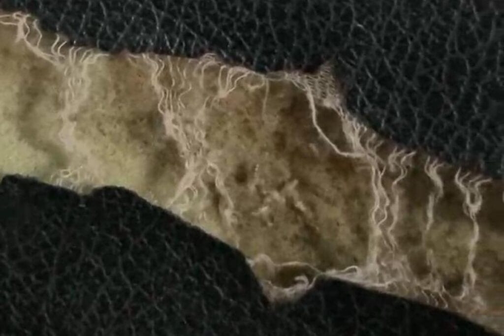 Bed pasien penuh belatung, RSUD Cut Meutia, kemenkes,