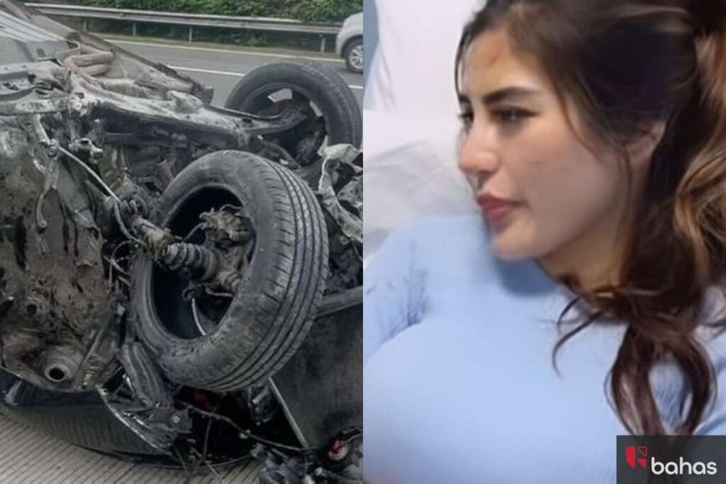 Diva Siregar Kecelakaan